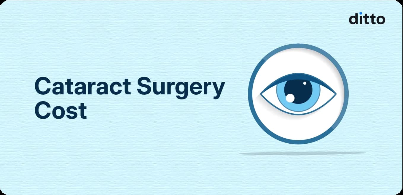 Cataract Surgery Cost in India