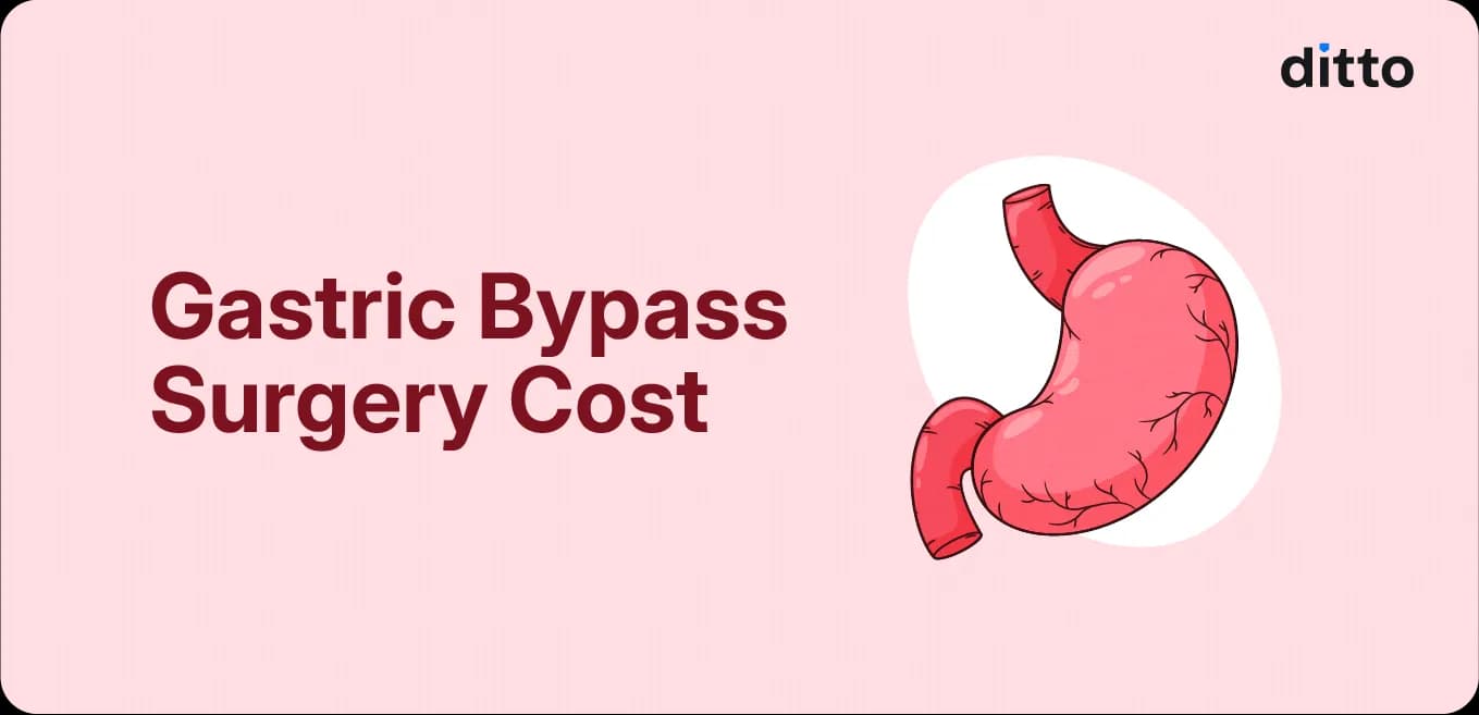 Gastric Bypass Surgery Cost: Complete Guide